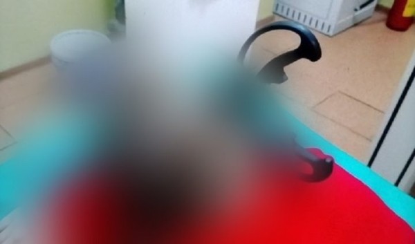 В Солигорске мать бросила кухонные ножницы в 12-летнюю дочь и сломала ей череп. Стали известны подробности